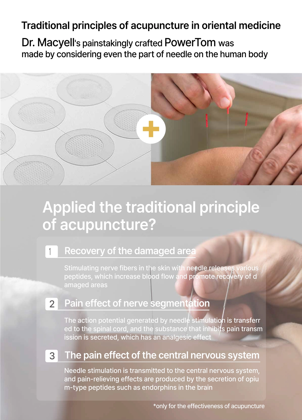 Traditional principles of acupuncture in oriental medicine: recovery, nerve segmentation, central nervous system (as presented)