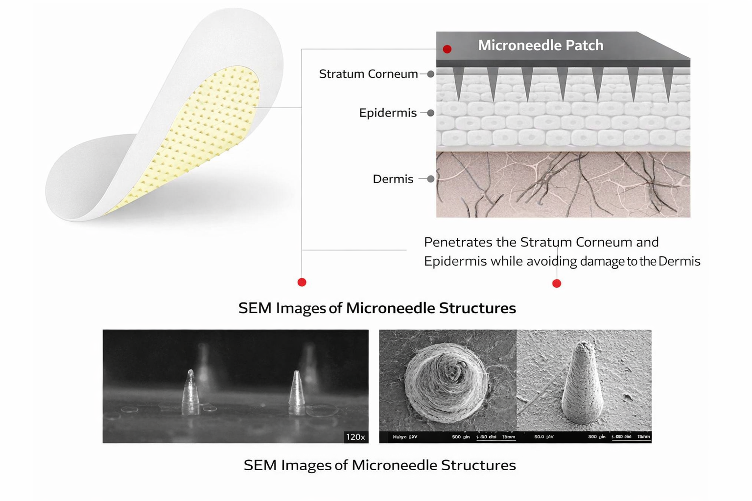 Microneedle patch structure: stratum corneum epidermis dermis with SEM images of microneedle structures